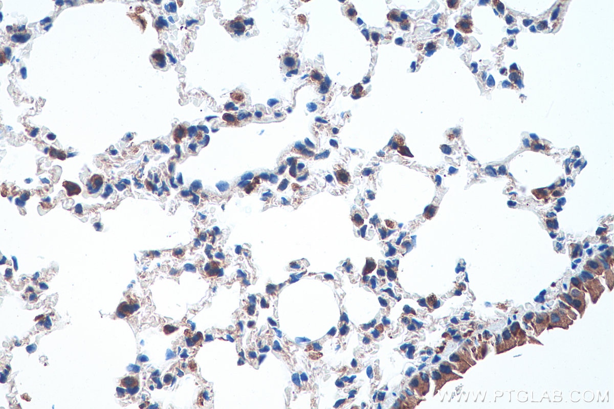 Immunohistochemical analysis of paraffin-embedded mouse lung tissue slide using KHC0208 (F4/80 IHC Kit).