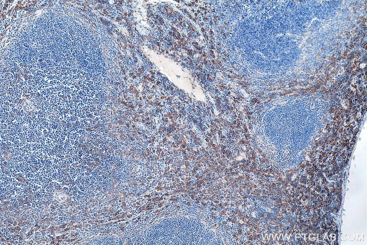 Immunohistochemical analysis of paraffin-embedded mouse spleen tissue slide using KHC0208 (F4/80 IHC Kit).