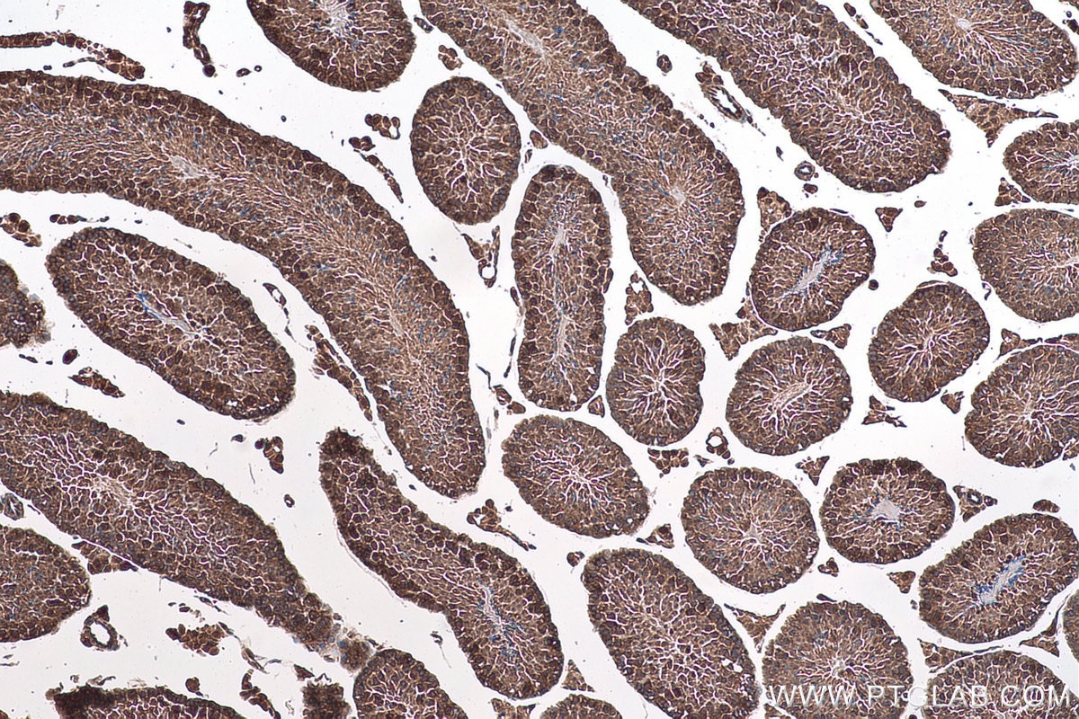 Immunohistochemical analysis of paraffin-embedded mouse testis tissue slide using KHC0950 (NAA10/ARD1A IHC Kit).