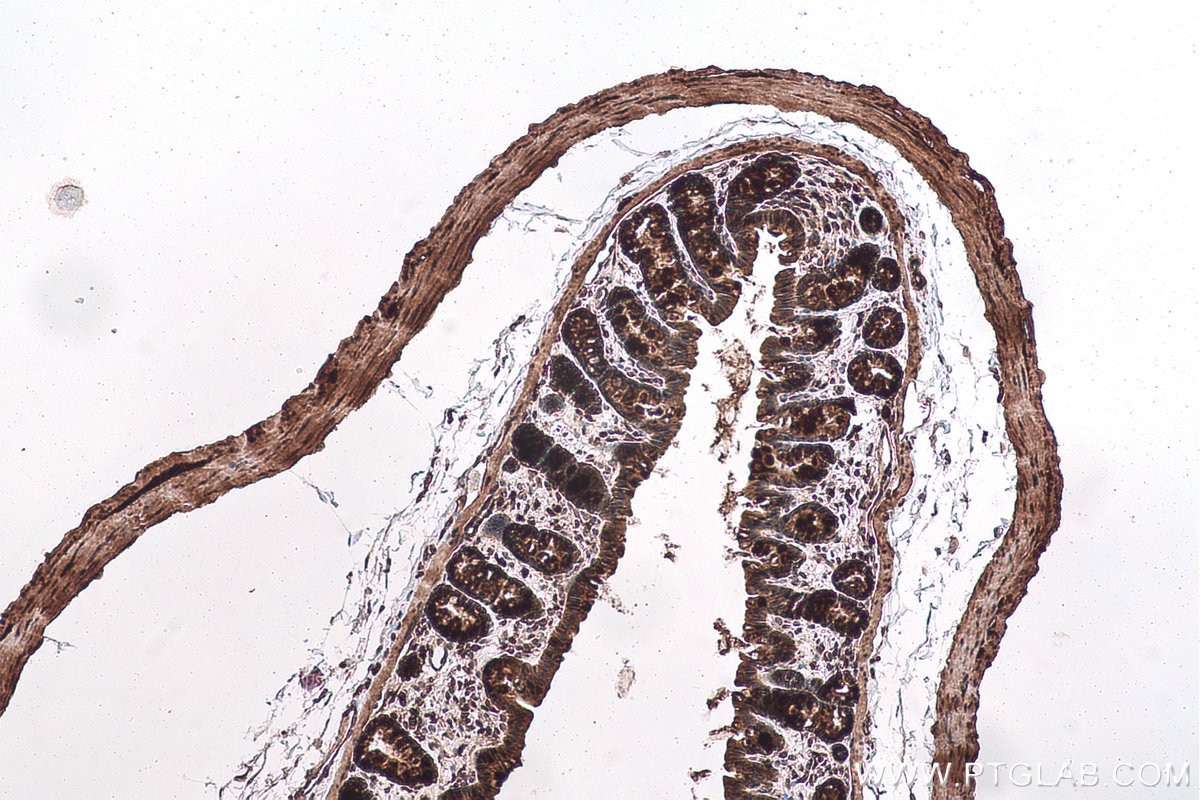 Immunohistochemical analysis of paraffin-embedded rat colon tissue slide using KHC0950 (NAA10/ARD1A IHC Kit).