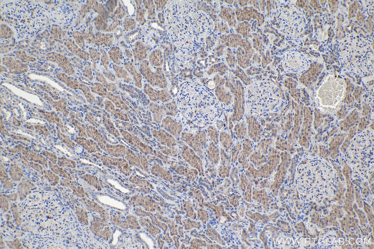 Immunohistochemical analysis of paraffin-embedded human kidney tissue slide using KHC0991 (NAA15/NARG1 IHC Kit).