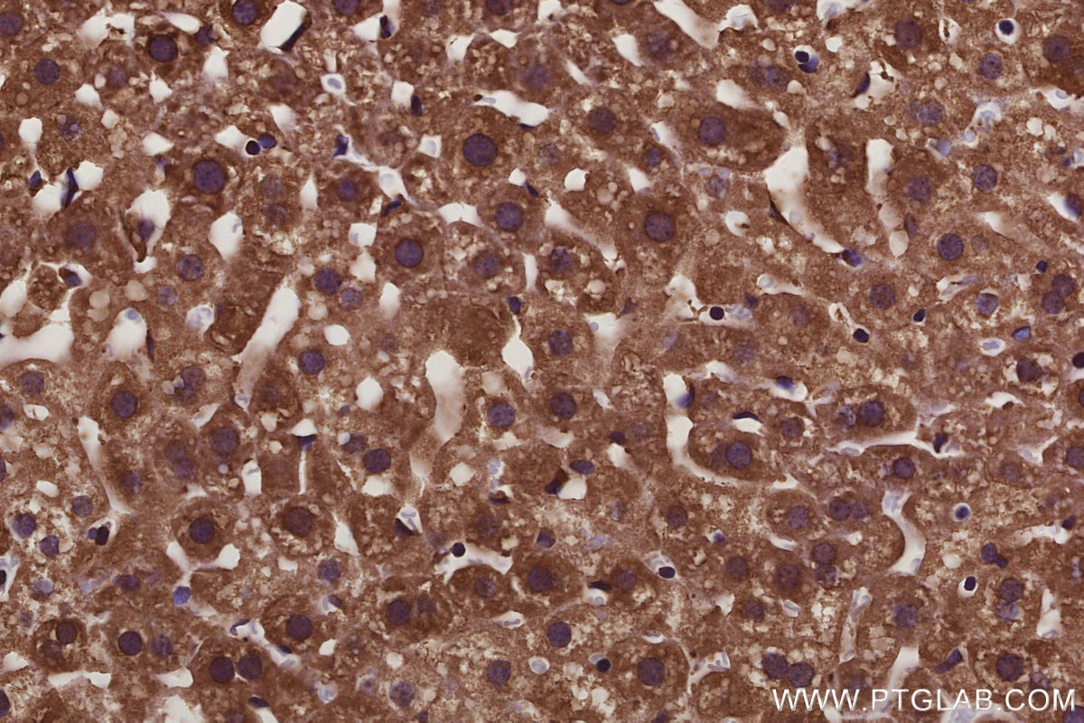 Immunohistochemical analysis of paraffin-embedded mouse liver tissue slide using KHC3098 (NACA IHC Kit).