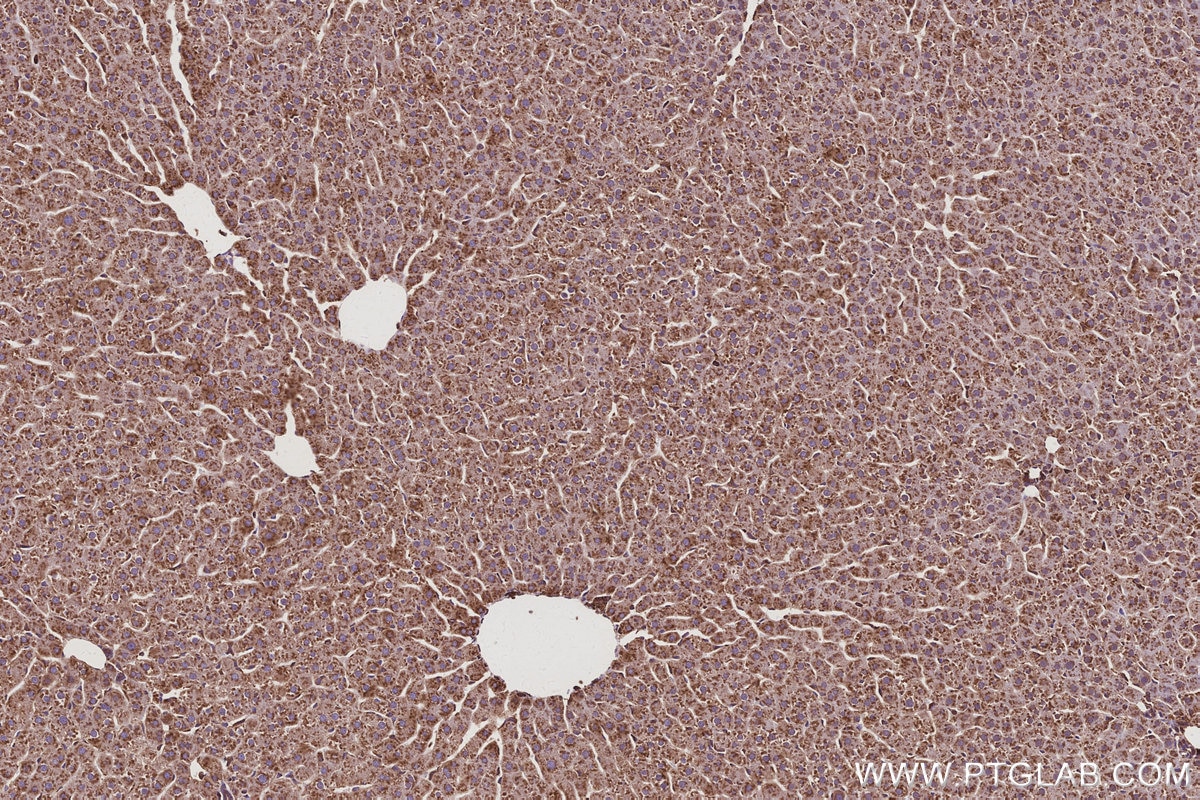 Immunohistochemical analysis of paraffin-embedded rat liver tissue slide using KHC3098 (NACA IHC Kit).