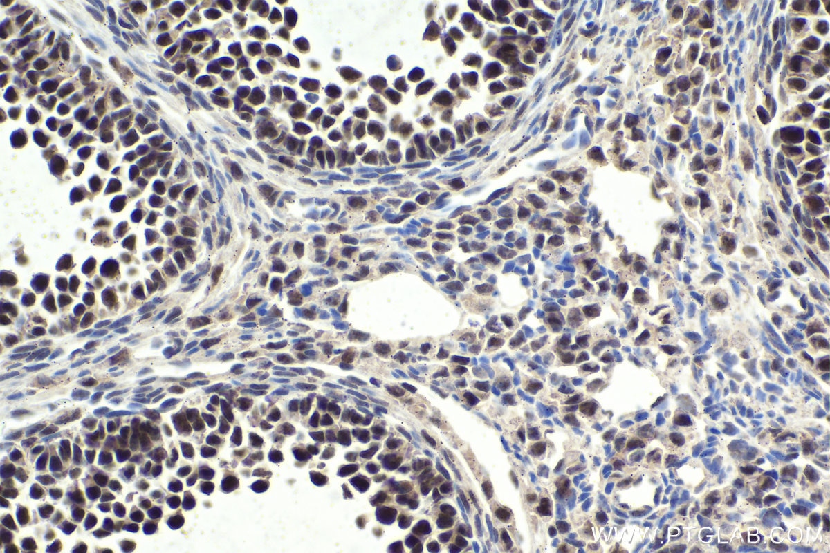 Immunohistochemical analysis of paraffin-embedded mouse ovary tissue slide using KHC1882 (NACC1 IHC Kit).