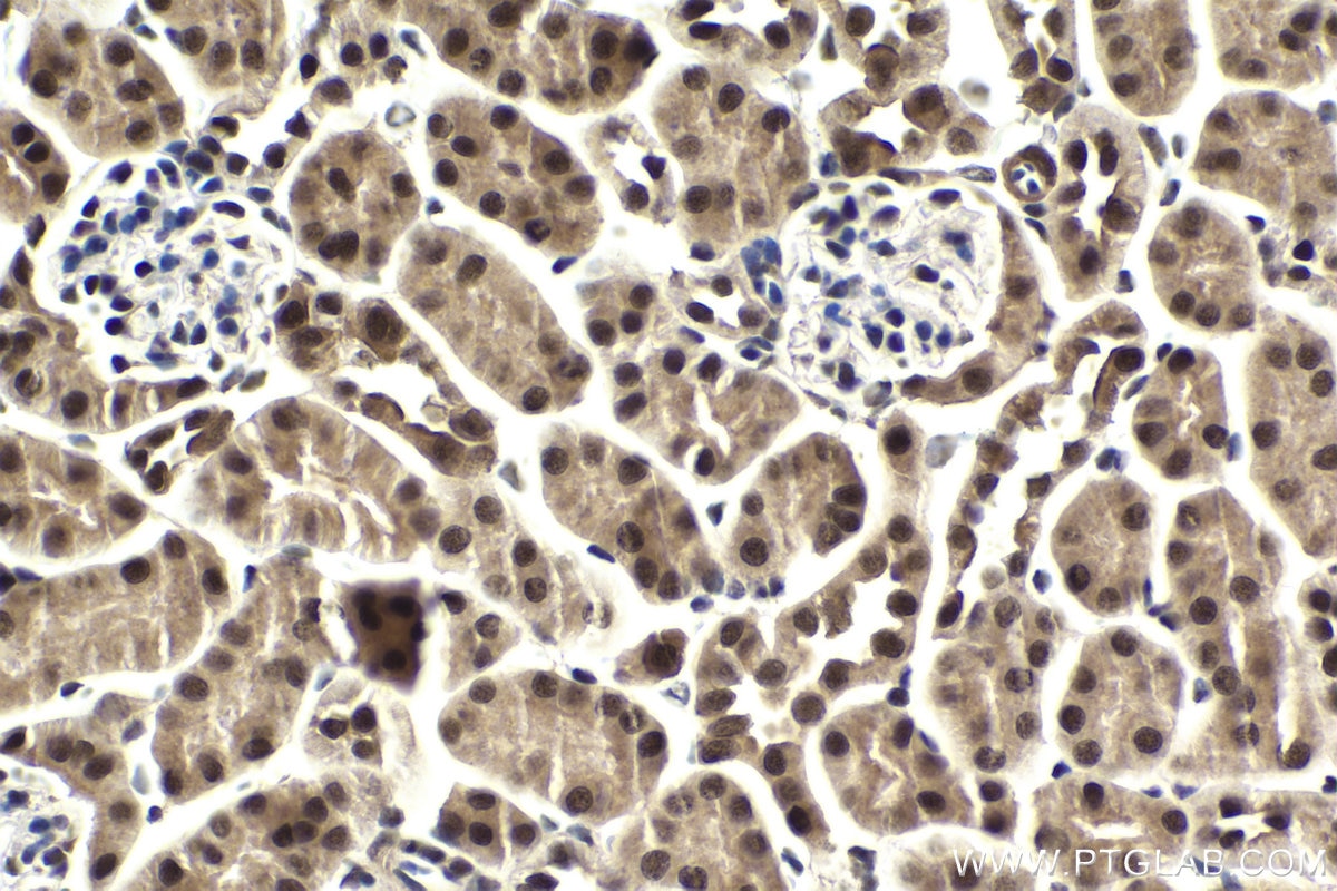Immunohistochemical analysis of paraffin-embedded mouse kidney tissue slide using KHC1882 (NACC1 IHC Kit).