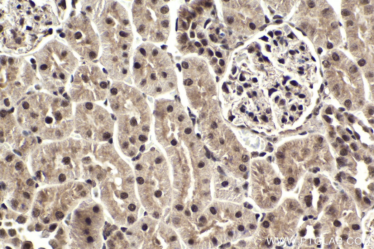 Immunohistochemical analysis of paraffin-embedded rat kidney tissue slide using KHC1882 (NACC1 IHC Kit).