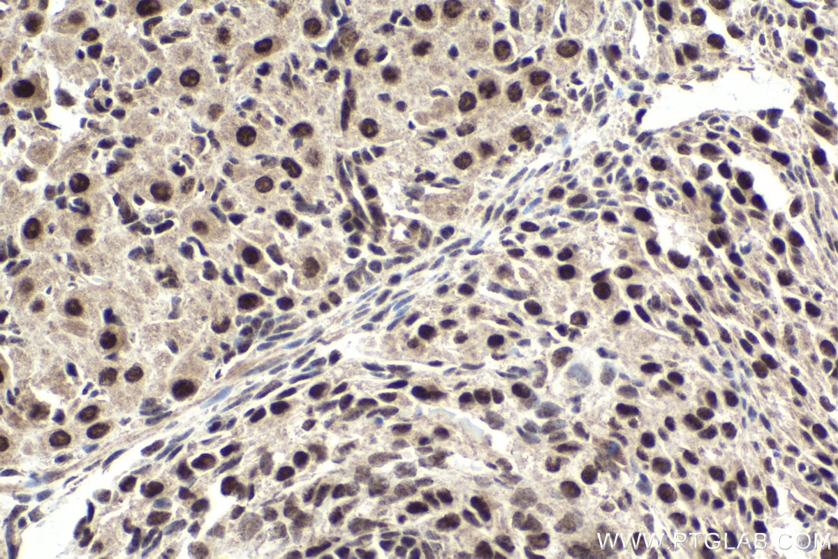 Immunohistochemical analysis of paraffin-embedded rat ovary tissue slide using KHC1882 (NACC1 IHC Kit).