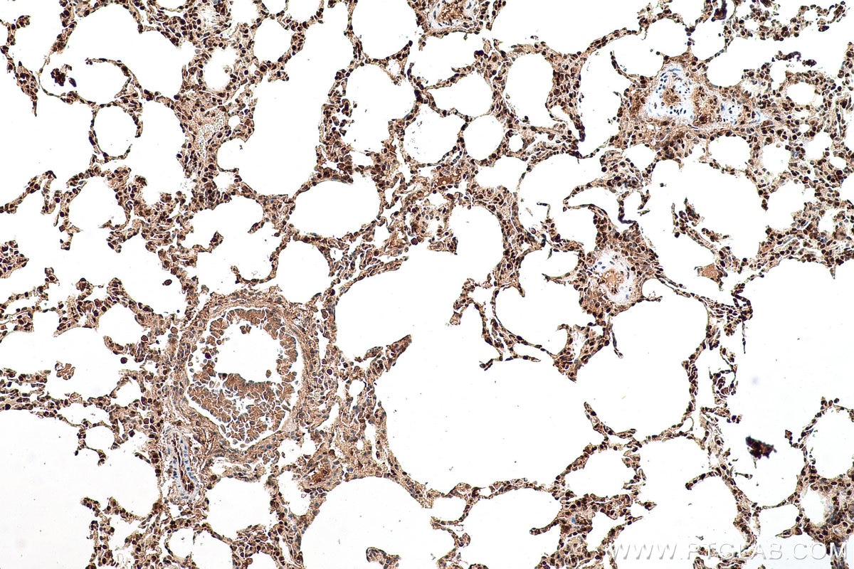 Immunohistochemical analysis of paraffin-embedded rat lung tissue slide using KHC0644 (NAMPT/PBEF IHC Kit).