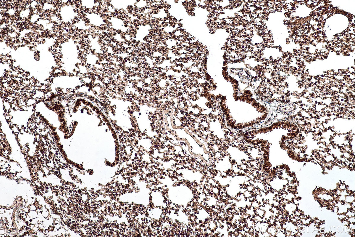 Immunohistochemical analysis of paraffin-embedded mouse lung tissue slide using KHC0644 (NAMPT/PBEF IHC Kit).