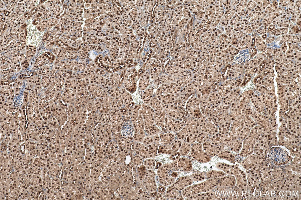 Immunohistochemical analysis of paraffin-embedded mouse kidney tissue slide using KHC0644 (NAMPT/PBEF IHC Kit).