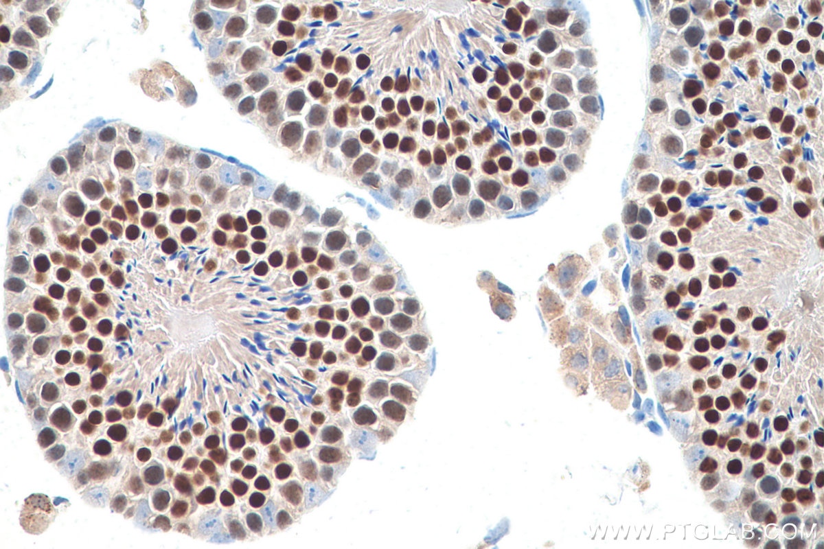 Immunohistochemical analysis of paraffin-embedded mouse testis tissue slide using KHC0842 (NASP IHC Kit).