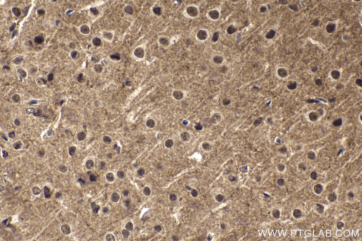 Immunohistochemical analysis of paraffin-embedded mouse brain tissue slide using KHC1687 (NCBP1 IHC Kit).