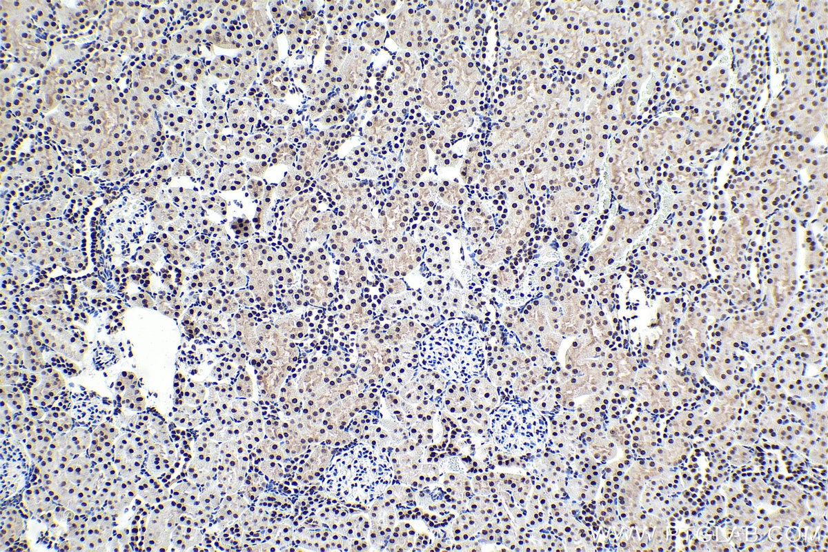 Immunohistochemical analysis of paraffin-embedded rat kidney tissue slide using KHC1621 (NCBP2 IHC Kit).