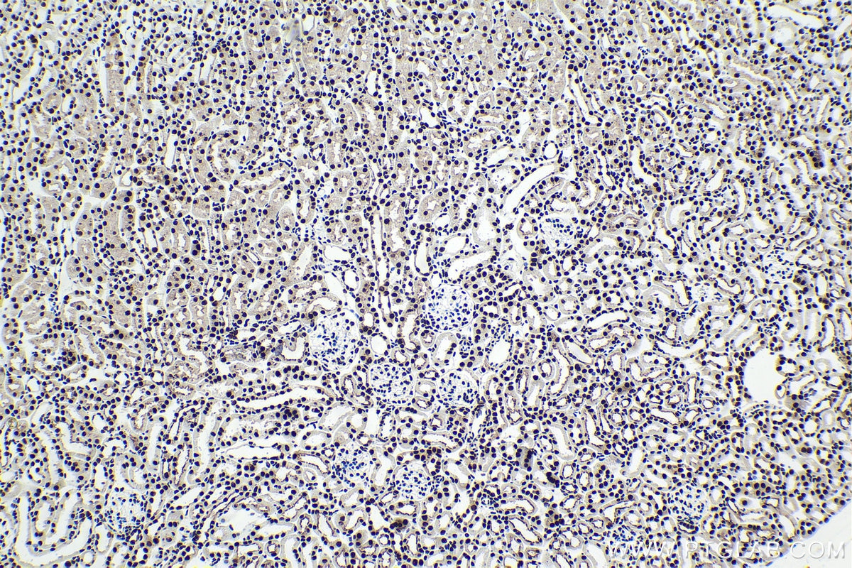 Immunohistochemical analysis of paraffin-embedded mouse kidney tissue slide using KHC1621 (NCBP2 IHC Kit).