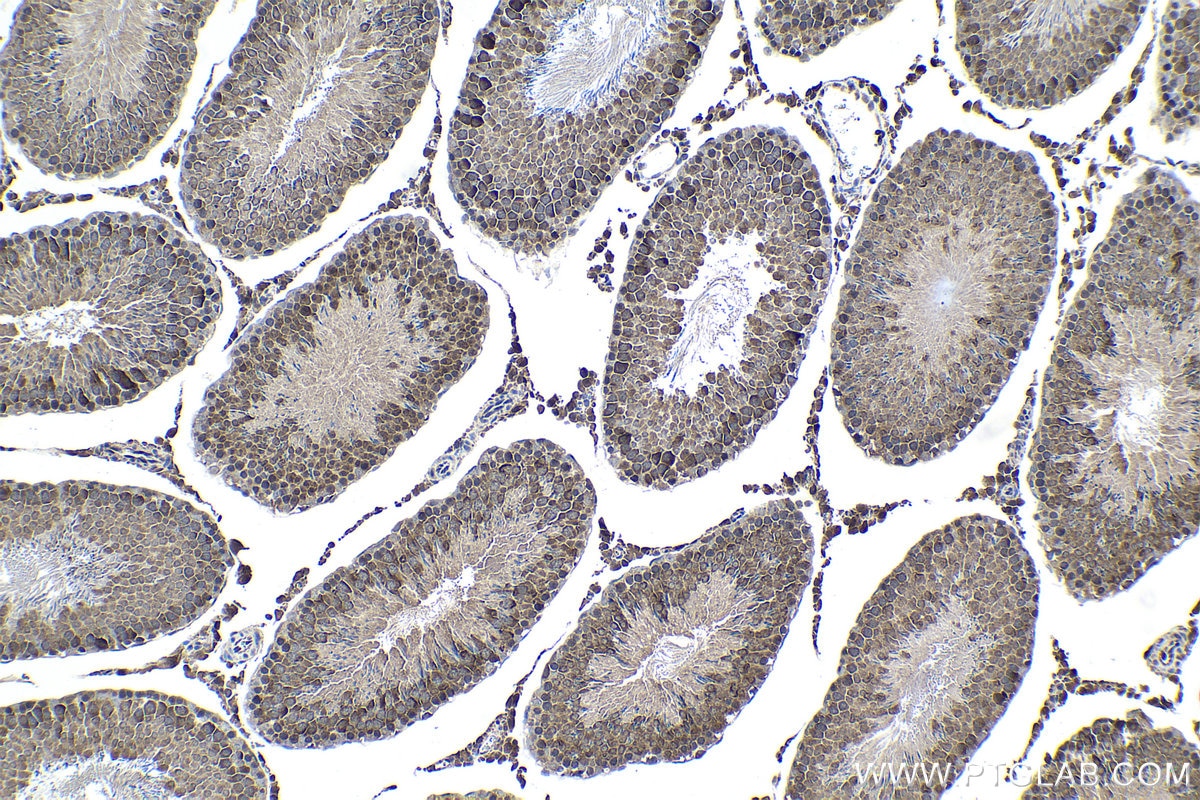 Immunohistochemical analysis of paraffin-embedded rat testis tissue slide using KHC1537 (NCK1 IHC Kit).
