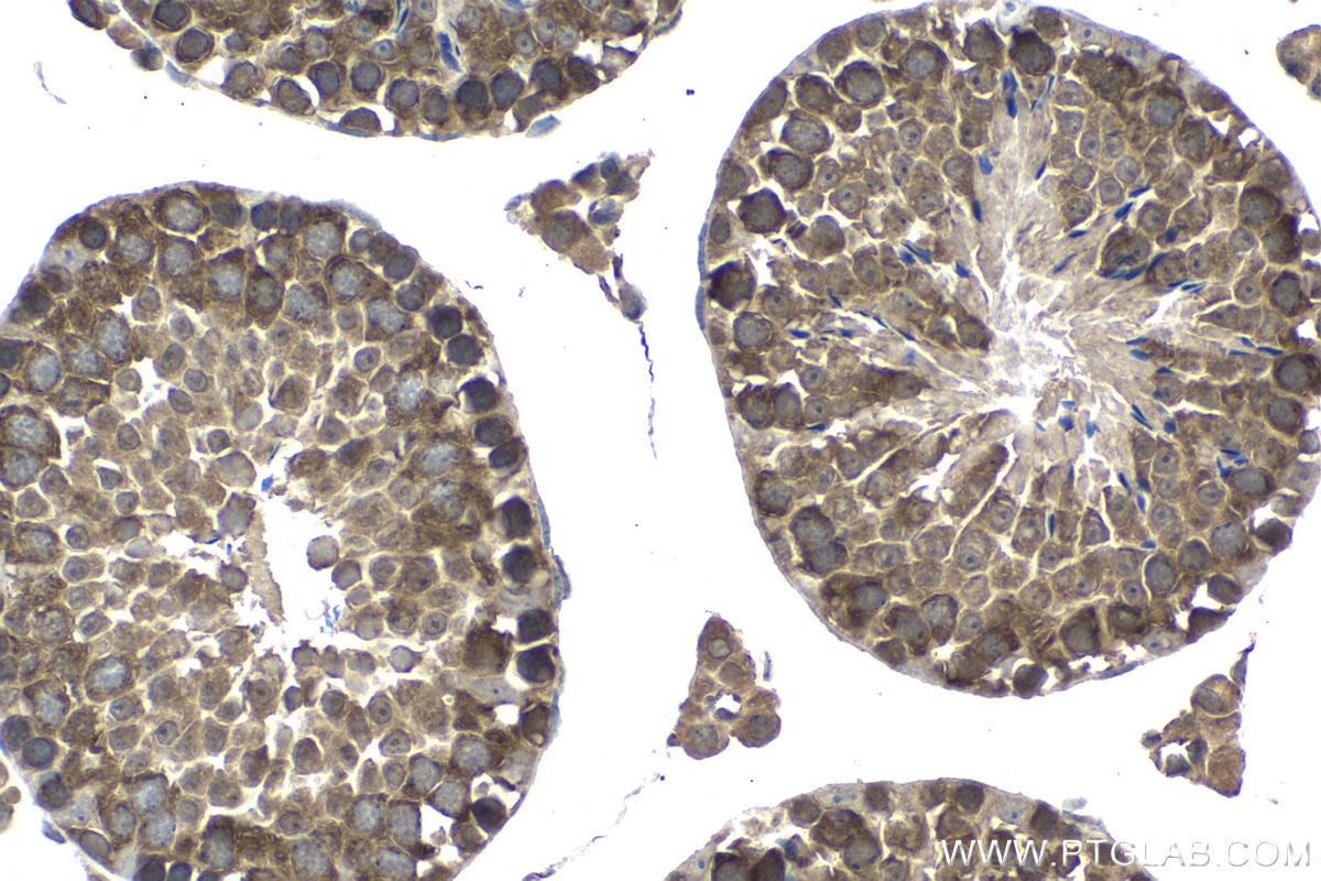 Immunohistochemical analysis of paraffin-embedded mouse testis tissue slide using KHC1537 (NCK1 IHC Kit).