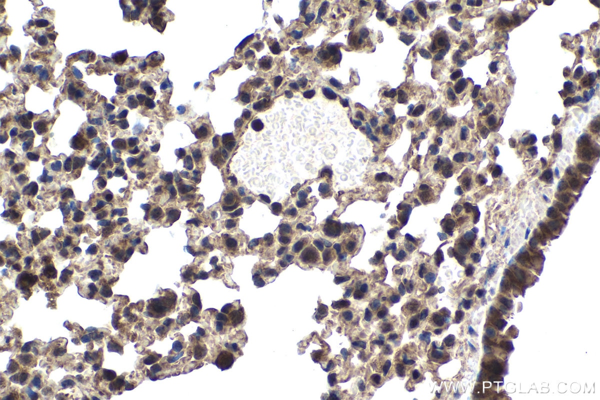 Immunohistochemical analysis of paraffin-embedded mouse lung tissue slide using KHC1537 (NCK1 IHC Kit).