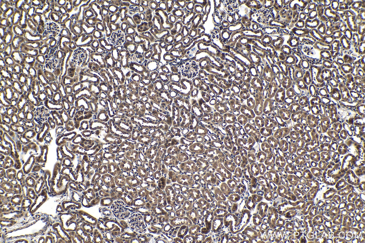 Immunohistochemical analysis of paraffin-embedded mouse kidney tissue slide using KHC1537 (NCK1 IHC Kit).