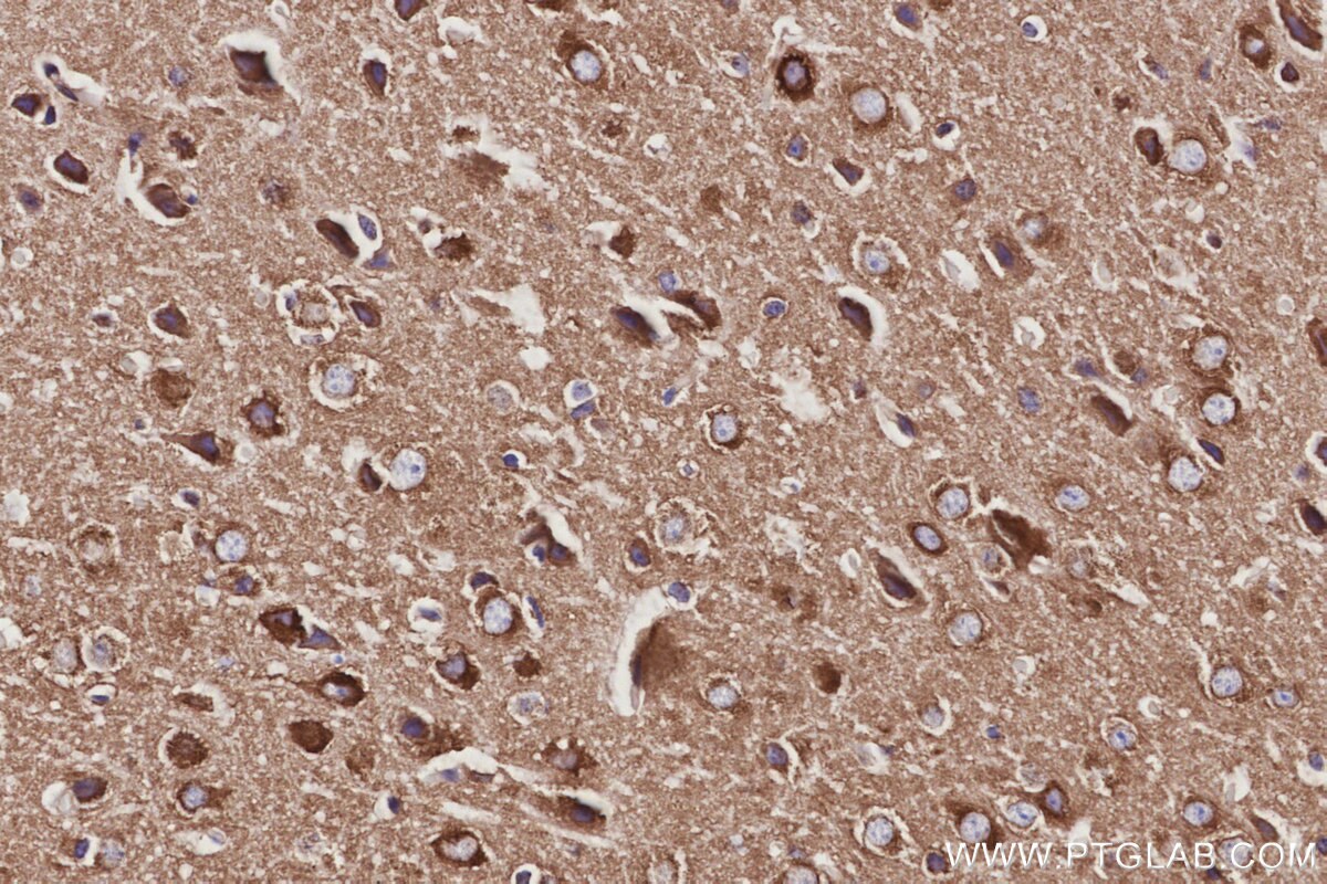 Immunohistochemical analysis of paraffin-embedded mouse brain tissue slide using KHC3053 (NCKAP1 IHC Kit). Immunohistochemical analysis of paraffin-embedded mouse brain tissue slide using KHC3053 (NCKAP1 IHC Kit).