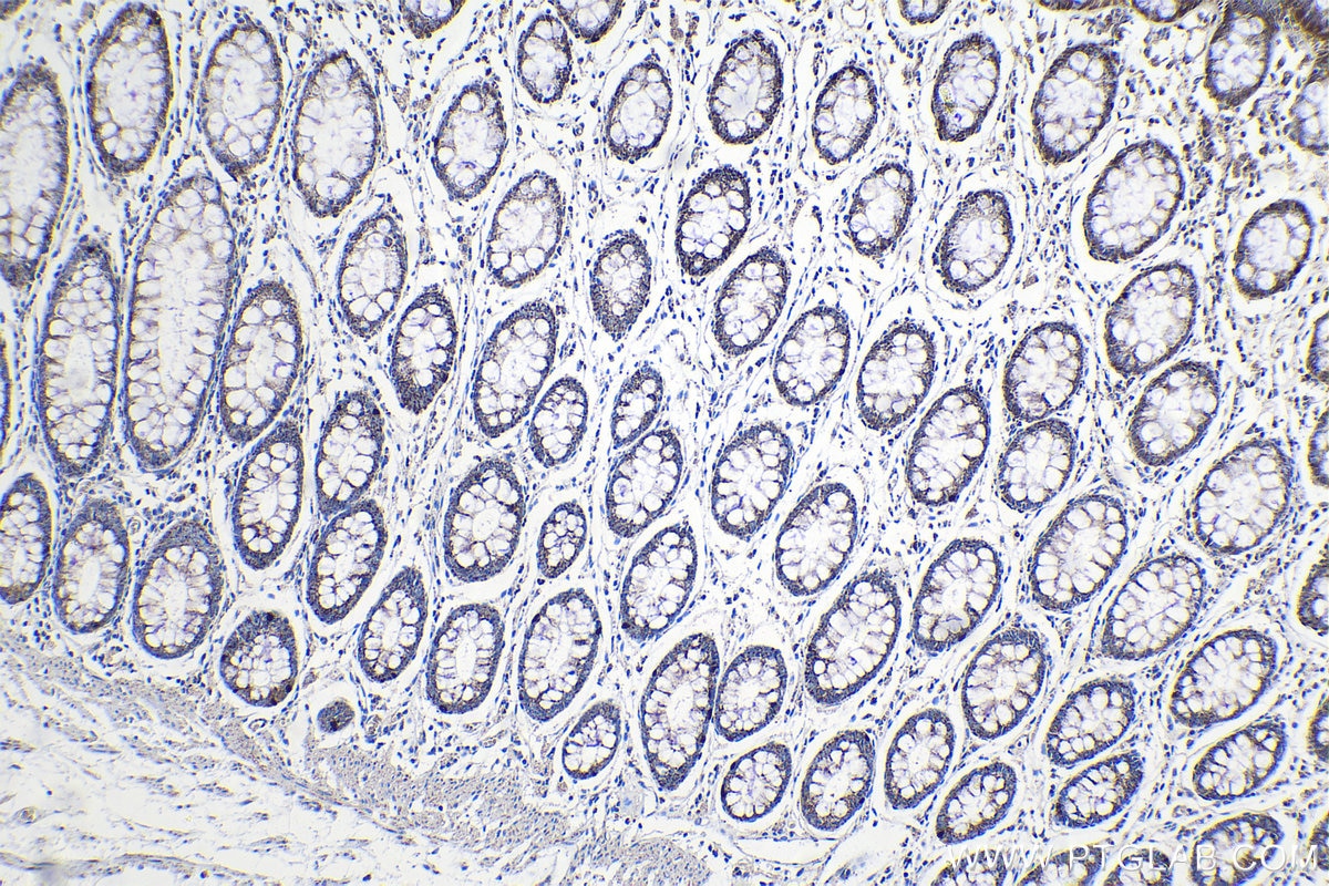 Immunohistochemical analysis of paraffin-embedded human colon tissue slide using KHC1140 (NCKAP1L IHC Kit).
