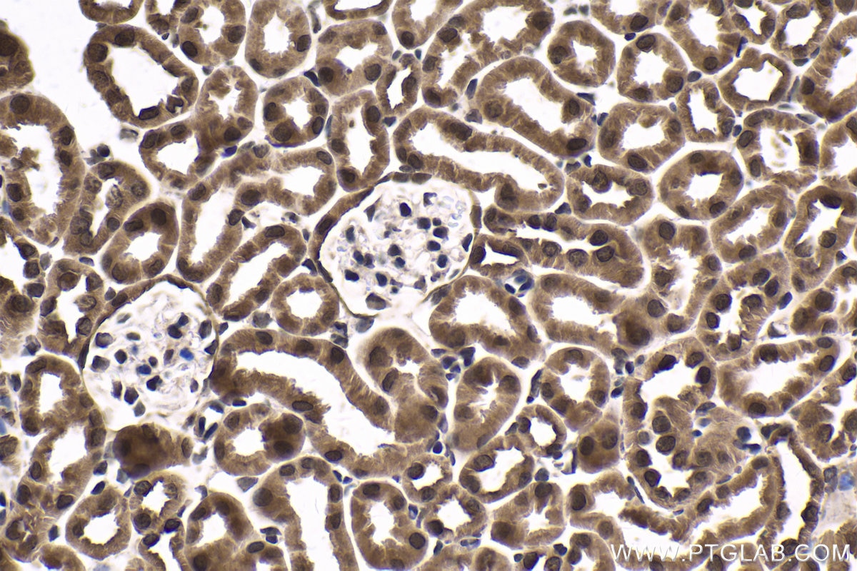 Immunohistochemical analysis of paraffin-embedded mouse kidney tissue slide using KHC1735 (NCOA6 IHC Kit).
