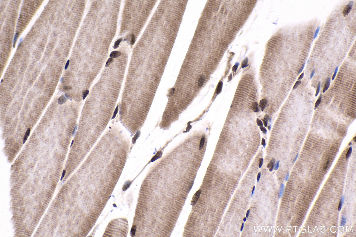 Immunohistochemical analysis of paraffin-embedded mouse skeletal muscle tissue slide using KHC1735 (NCOA6 IHC Kit).