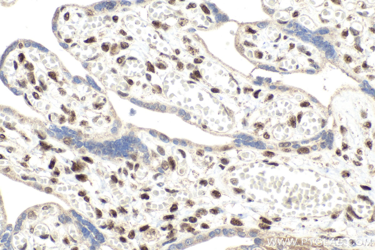 Immunohistochemical analysis of paraffin-embedded human placenta tissue slide using KHC2030 (NCOR2 IHC Kit).