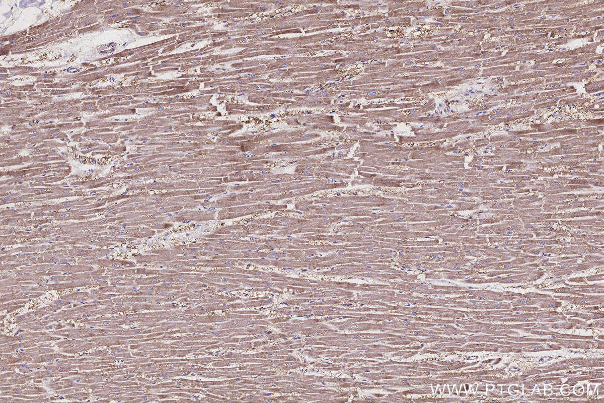 Immunohistochemical analysis of paraffin-embedded human heart tissue slide using KHC3162 (ND1 IHC Kit).