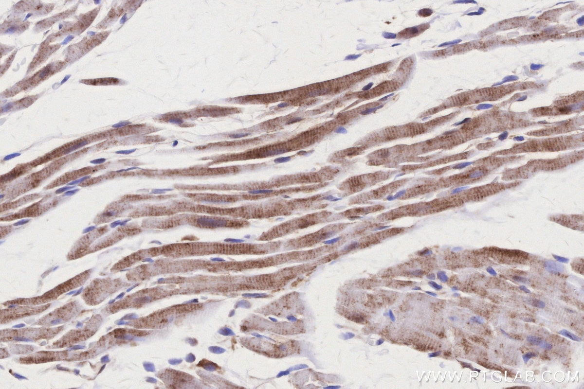 Immunohistochemical analysis of paraffin-embedded rat heart tissue slide using KHC3162 (ND1 IHC Kit).