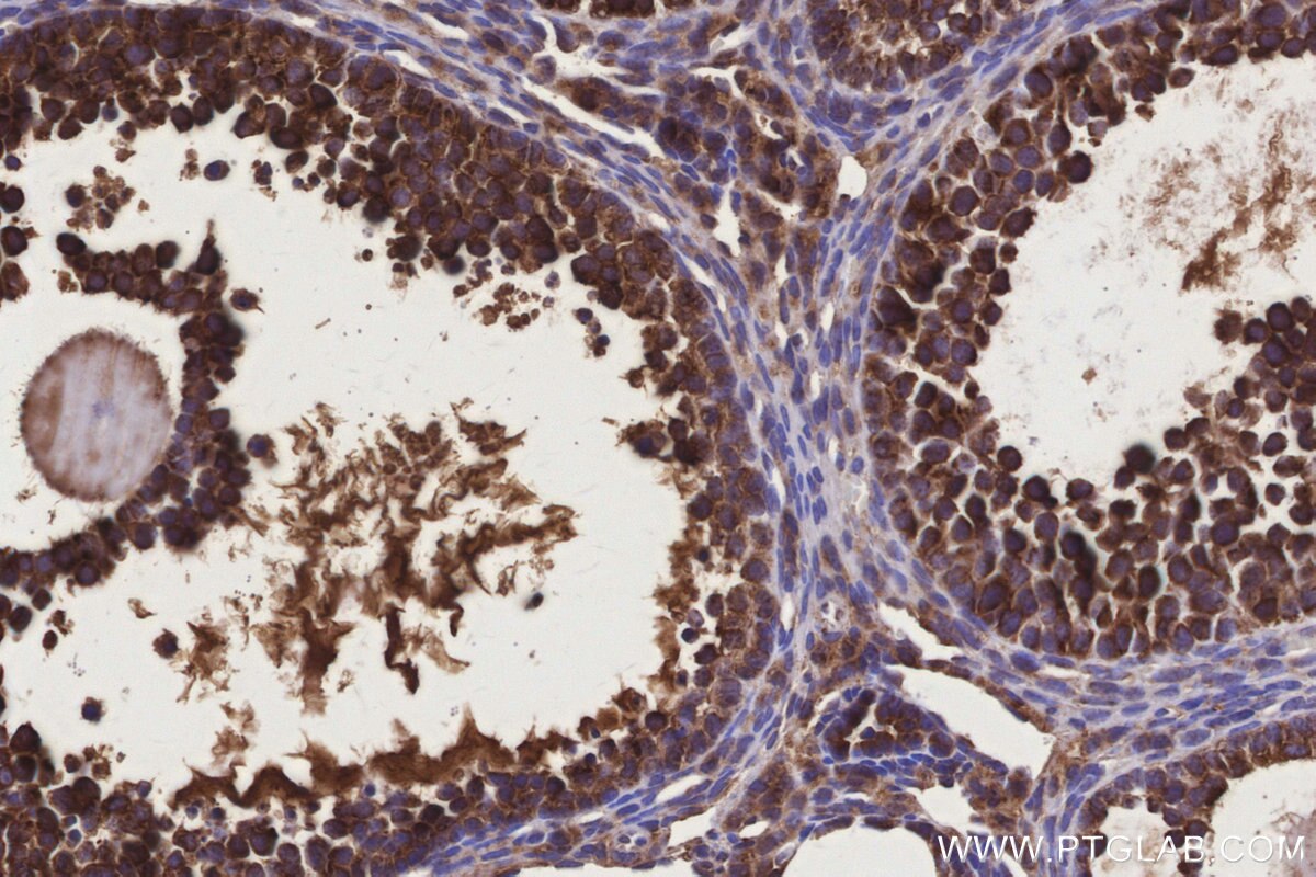 Immunohistochemical analysis of paraffin-embedded mouse ovary tissue slide using KHC3164 (ND4 IHC Kit).