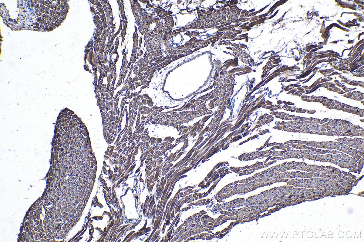 Immunohistochemical analysis of paraffin-embedded mouse heart tissue slide using KHC1010 (NDRG2 IHC Kit).