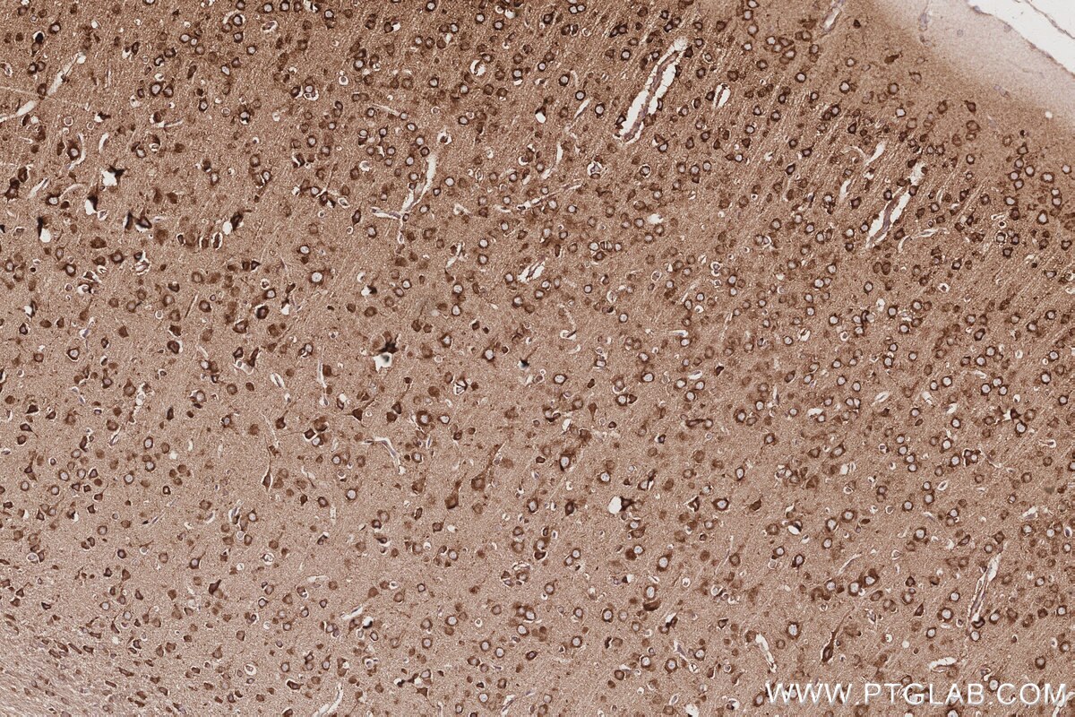 Immunohistochemical analysis of paraffin-embedded rat brain tissue slide using KHC3037 (NDRG4 IHC Kit).