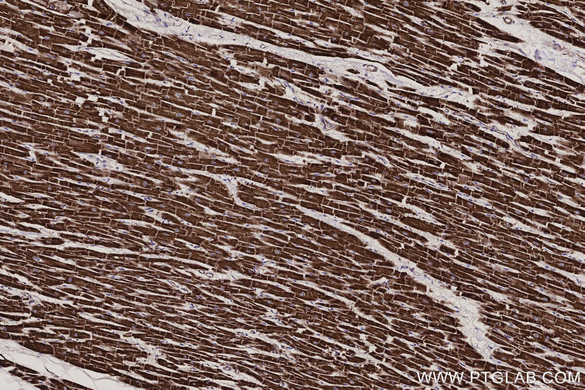Immunohistochemical analysis of paraffin-embedded human heart tissue slide using KHC3137 (NDUFA1 IHC Kit).