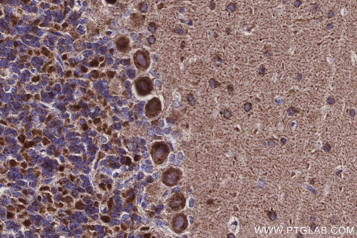 Immunohistochemical analysis of paraffin-embedded rat cerebellum tissue slide using KHC3137 (NDUFA1 IHC Kit).
