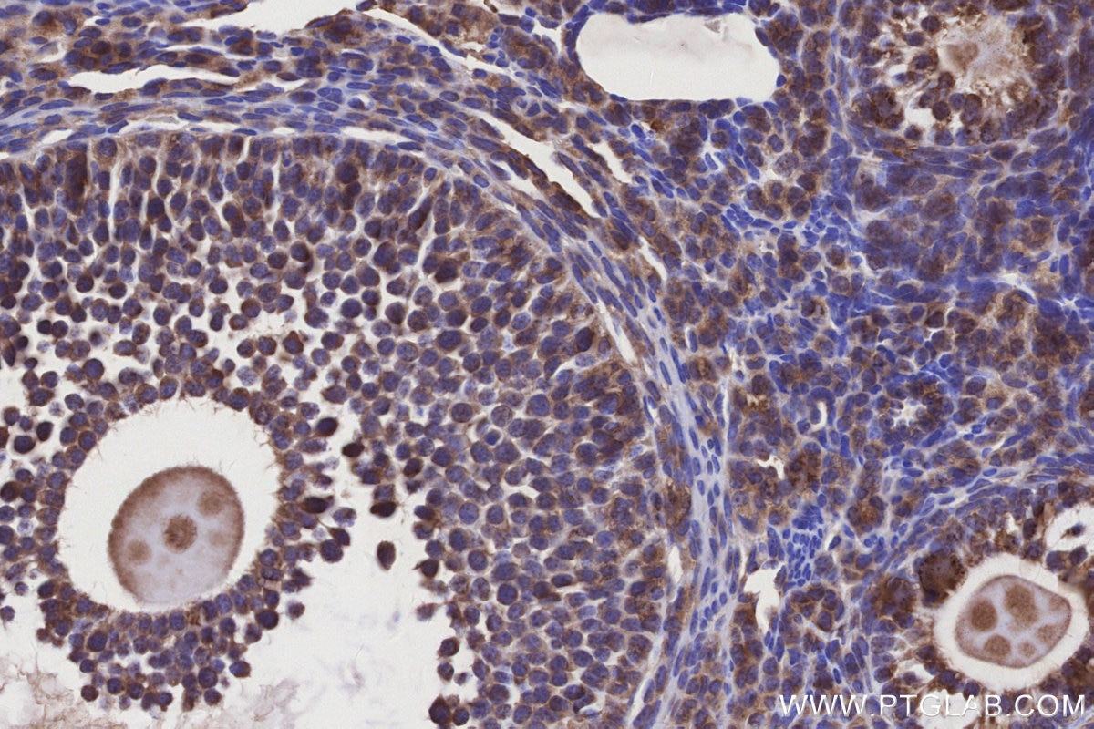 Immunohistochemical analysis of paraffin-embedded mouse ovary tissue slide using KHC3155 (NDUFA10 IHC Kit). Immunohistochemical analysis of paraffin-embedded mouse ovary tissue slide using KHC3155 (NDUFA10 IHC Kit).