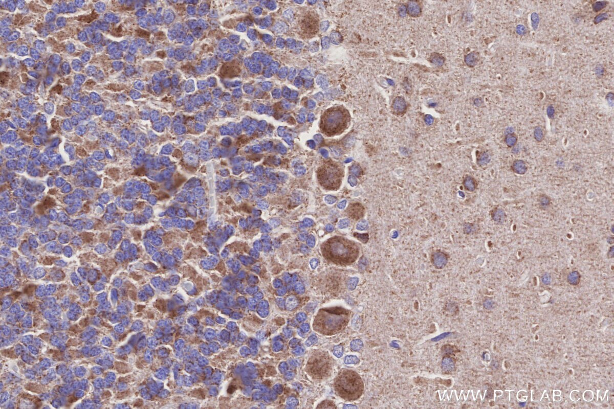 Immunohistochemical analysis of paraffin-embedded rat cerebellum tissue slide using KHC3155 (NDUFA10 IHC Kit). Immunohistochemical analysis of paraffin-embedded rat cerebellum tissue slide using KHC3155 (NDUFA10 IHC Kit).