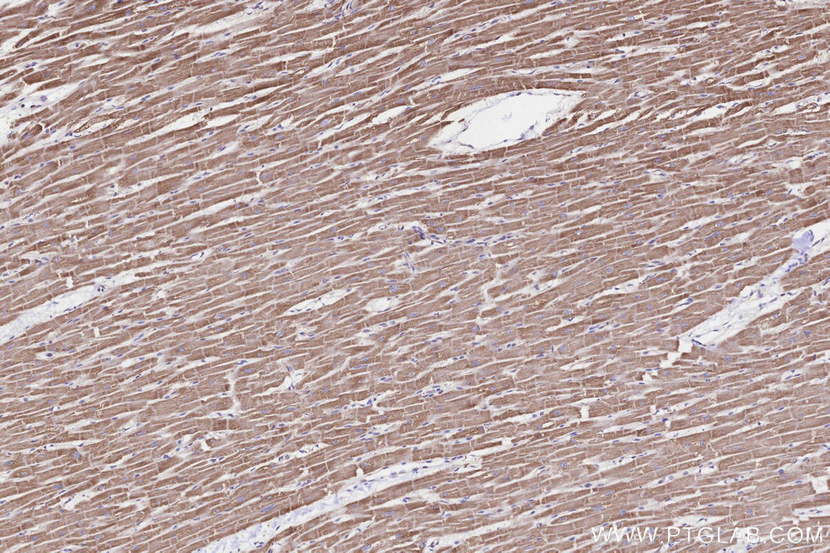 Immunohistochemical analysis of paraffin-embedded human heart tissue slide using KHC3285 (NDUFA11 IHC Kit). Immunohistochemical analysis of paraffin-embedded human heart tissue slide using KHC3285 (NDUFA11 IHC Kit).