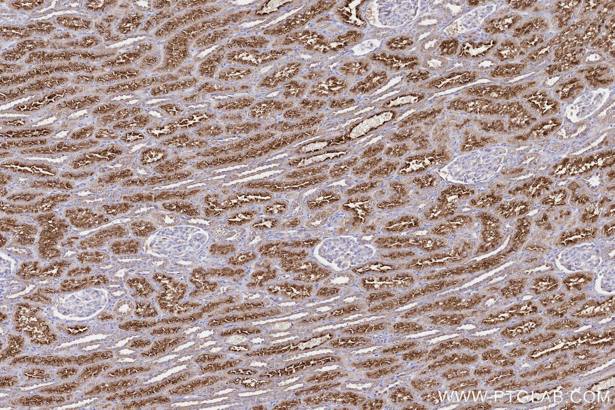 Immunohistochemical analysis of paraffin-embedded human kidney tissue slide using KHC3285 (NDUFA11 IHC Kit). Immunohistochemical analysis of paraffin-embedded human kidney tissue slide using KHC3285 (NDUFA11 IHC Kit).