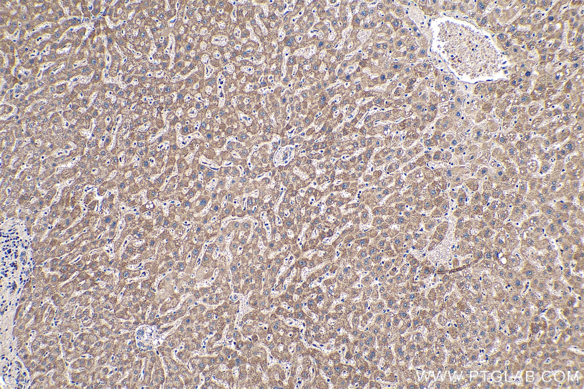 Immunohistochemical analysis of paraffin-embedded human liver tissue slide using KHC0246 (NDUFA13 IHC Kit).