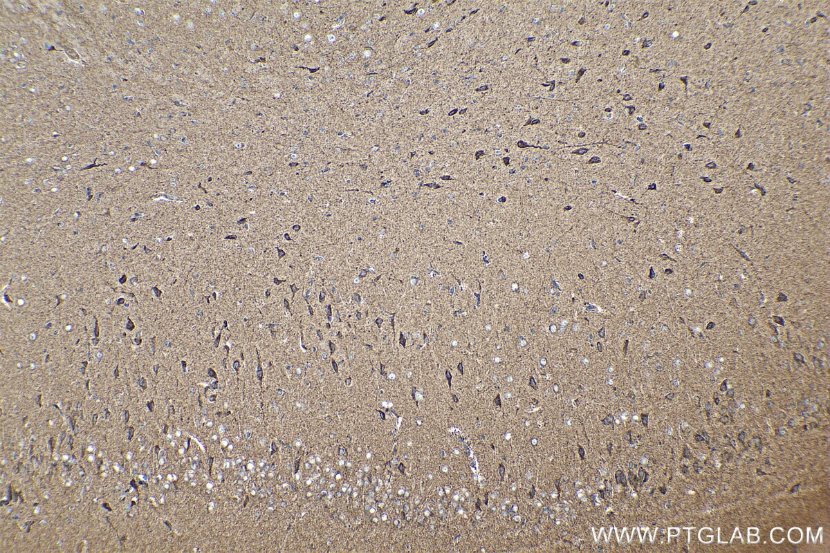 Immunohistochemical analysis of paraffin-embedded rat brain tissue slide using KHC0246 (NDUFA13 IHC Kit).