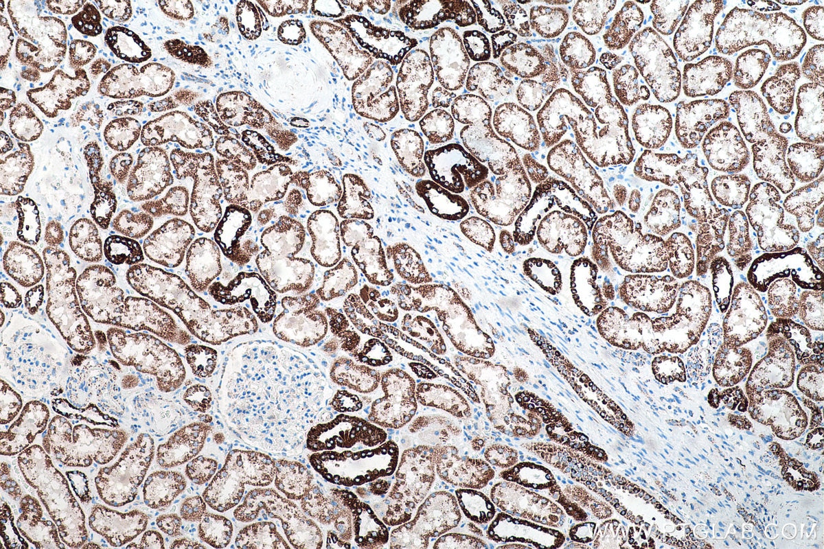 Immunohistochemical analysis of paraffin-embedded human kidney tissue slide using KHC0201 (NDUFA4L2 IHC Kit).