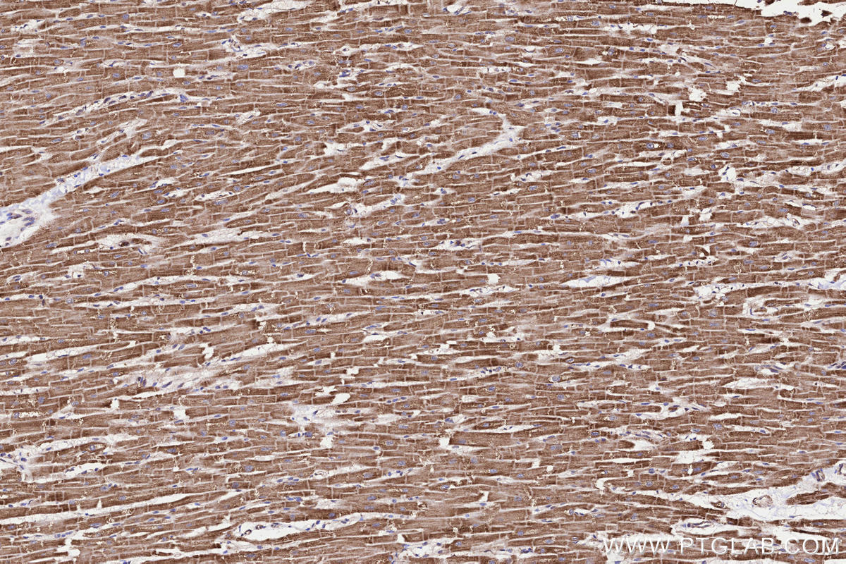 Immunohistochemical analysis of paraffin-embedded human heart tissue slide using KHC3233 (NDUFA6 IHC Kit).
