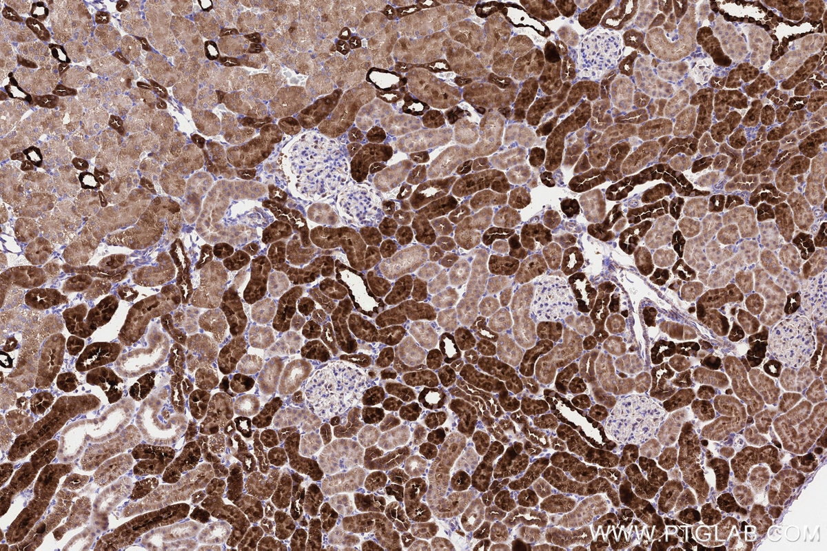 Immunohistochemical analysis of paraffin-embedded rat kidney tissue slide using KHC3225 (NDUFA8 IHC Kit). Immunohistochemical analysis of paraffin-embedded rat kidney tissue slide using KHC3225 (NDUFA8 IHC Kit).