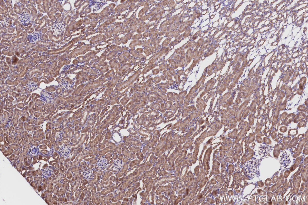 Immunohistochemical analysis of paraffin-embedded mouse kidney tissue slide using KHC3225 (NDUFA8 IHC Kit). Immunohistochemical analysis of paraffin-embedded mouse kidney tissue slide using KHC3225 (NDUFA8 IHC Kit).