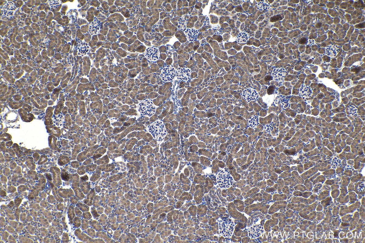 Immunohistochemical analysis of paraffin-embedded mouse kidney tissue slide using KHC1397 (NDUFAF1 IHC Kit).