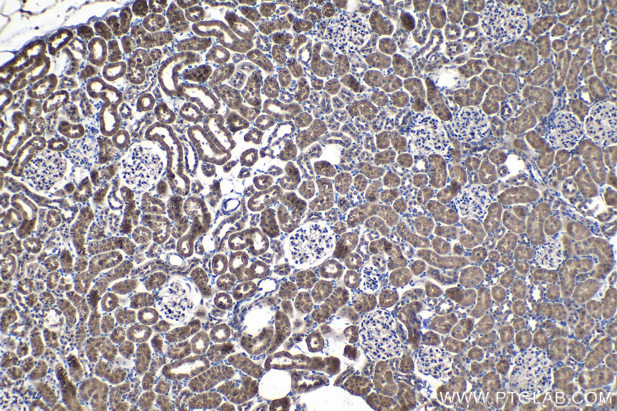 Immunohistochemical analysis of paraffin-embedded rat kidney tissue slide using KHC1397 (NDUFAF1 IHC Kit).