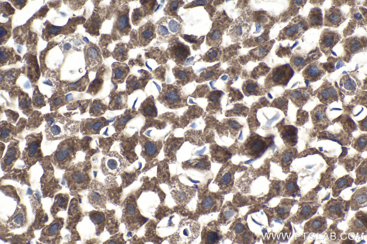 Immunohistochemical analysis of paraffin-embedded mouse liver tissue slide using KHC1397 (NDUFAF1 IHC Kit).