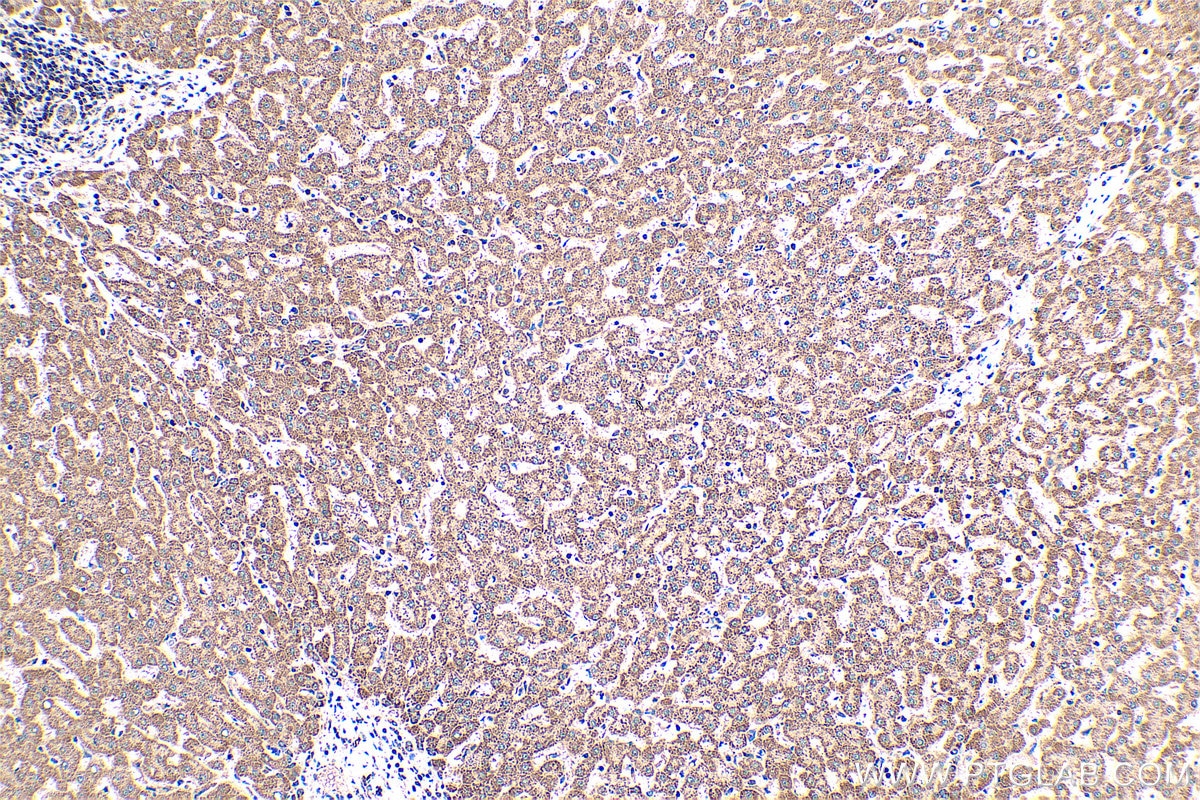 Immunohistochemical analysis of paraffin-embedded human liver tissue slide using KHC0439 (NDUFAF2 IHC Kit).