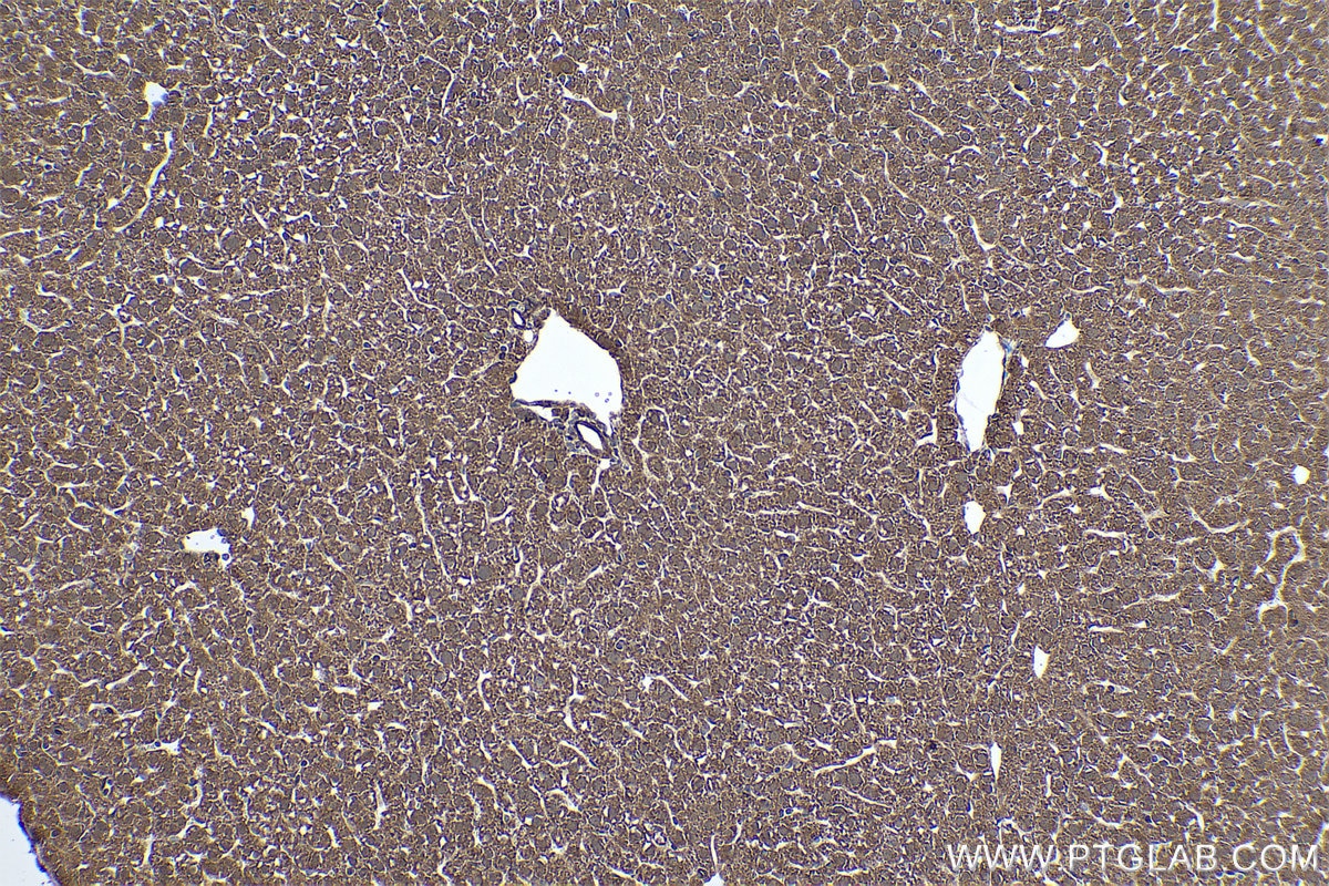 Immunohistochemical analysis of paraffin-embedded mouse liver tissue slide using KHC0439 (NDUFAF2 IHC Kit).