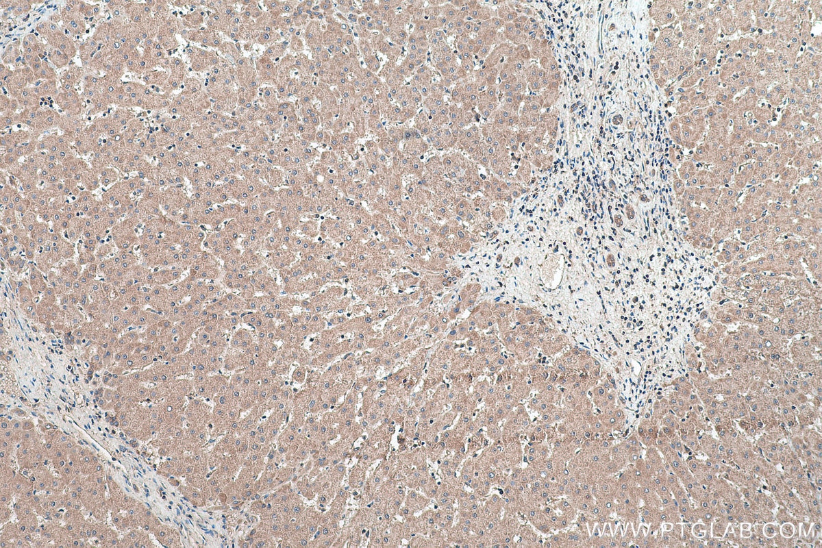 Immunohistochemical analysis of paraffin-embedded human liver tissue slide using KHC0440 (NDUFAF4 IHC Kit).